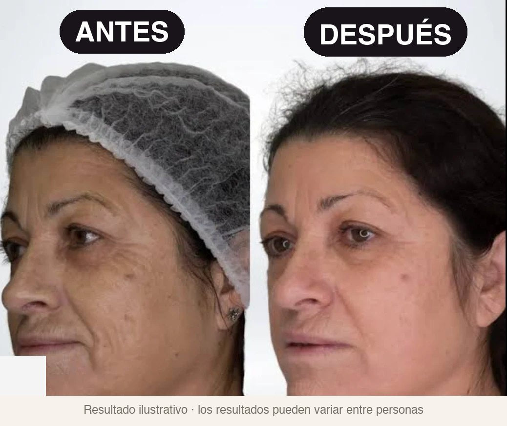 Antes y después · contorno de ojos más firme