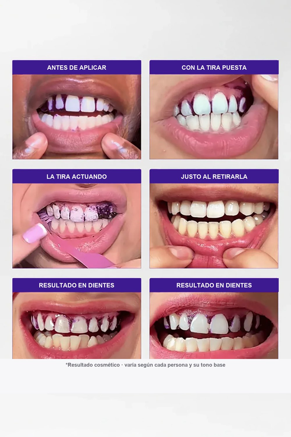 Resultados en dientes tras una aplicación